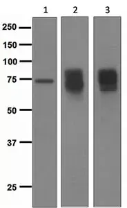 Anti-Somatostatin Receptor 2 antibody [UMB1] - C-terminal(AB134152)
