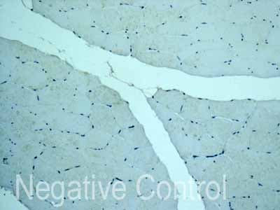 Cyp26a1 Antibody Epr11841 Ab172474  Immunohistochemistry Formalin Pfa Fixed Paraffin Embedded Sections Img49453