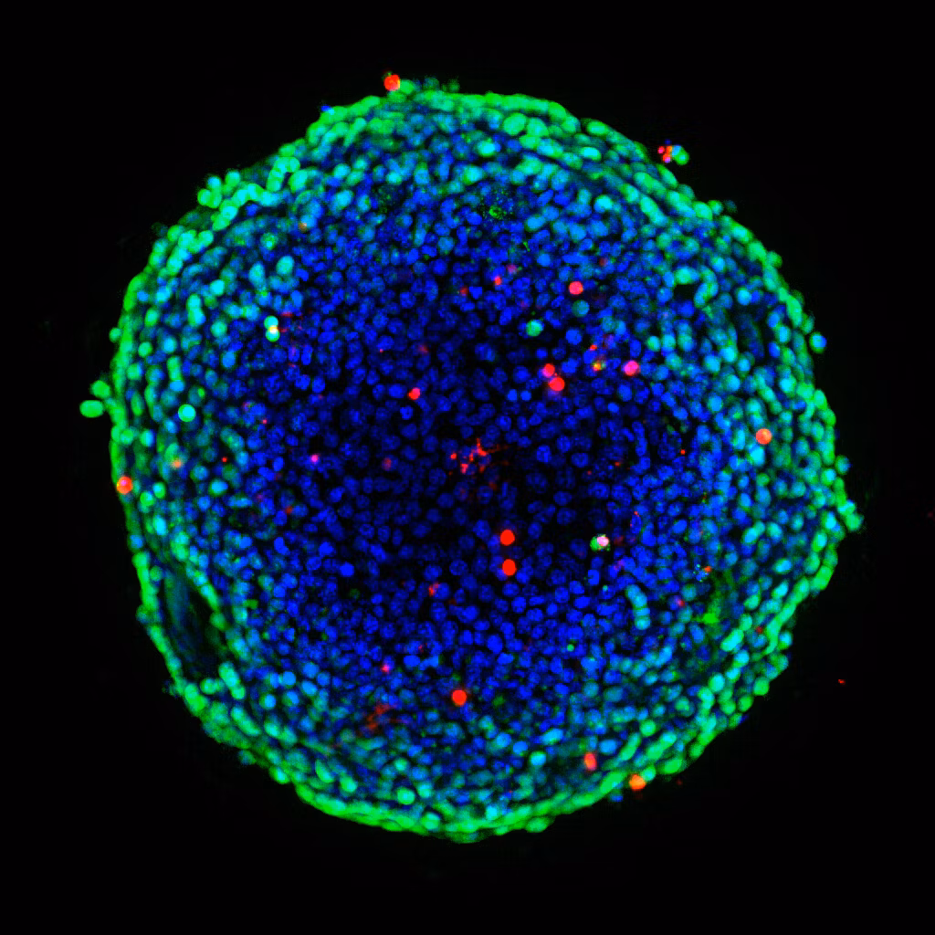 Molecular Devices Micro Confocal Imagexpress High Content Imaging Solution Image2