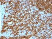 Cd45ra Antibody Ptprc 1148 Bsa And Azide Free Ab212774  Immunohistochemistry Formalin Pfa Fixed Paraffin Embedded Sections Img114591