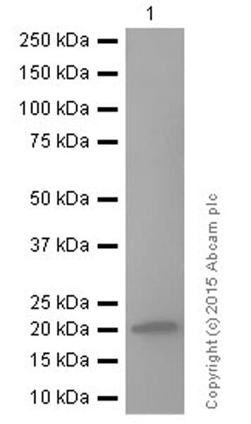 Rbp4 Antibody Ep3657 Ab109193  Western Blot Img152289