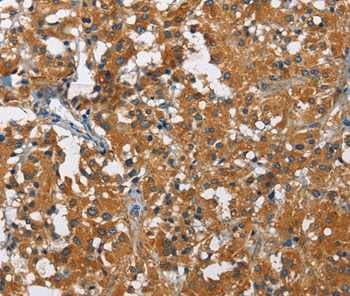 Klf7 Antibody Ab197690  Immunohistochemistry Formalin Pfa Fixed Paraffin Embedded Sections Img46064