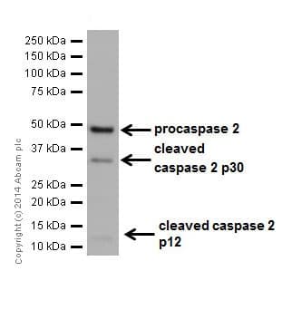 Caspase 2l Antibody Epr16790 Ab179519  Western Blot Img14312
