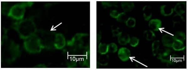 Anti-CD45 antibody [MEM-28](AB8216)