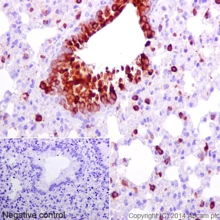 Cxcl15 Antibody Epr14470 Ab197016  Immunohistochemistry Formalin Pfa Fixed Paraffin Embedded Sections Img65688