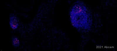 Alexa Fluor 647 Ccr7 Antibody Epr23192 57 Ab275165  Immunohistochemistry Formalin Pfa Fixed Paraffin Embedded Sections Img432784