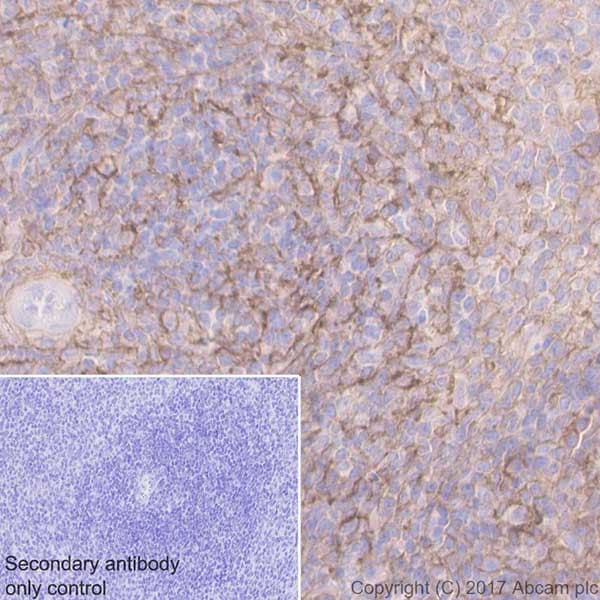 Anti-CD44 antibody [EPR18668](AB189524)