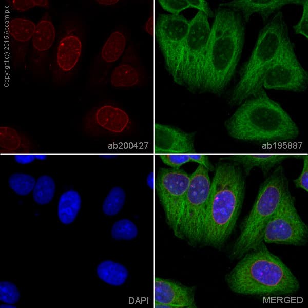 Alexa Fluor® 647 Anti-Lamin B2 antibody [EPR9701(B)](AB200427)