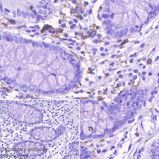 Anti-CD14 antibody [SP192](AB183322)