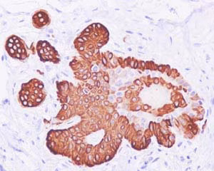 Cytokeratin 19 Antibody Ep1580y Cytoskeleton Marker Ab52625 Immunohistochemistry Formalin Pfa Fixed Paraffin Emb 4p7OTTaDtt