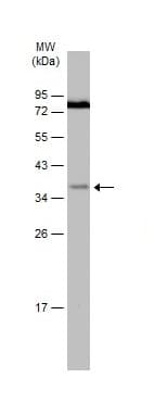 Anti-IGFBP3 antibody(AB272857)