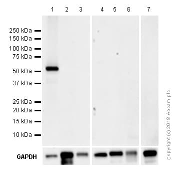 Anti-MLKL (phospho S345) antibody [EPR9515(2)](AB196436)