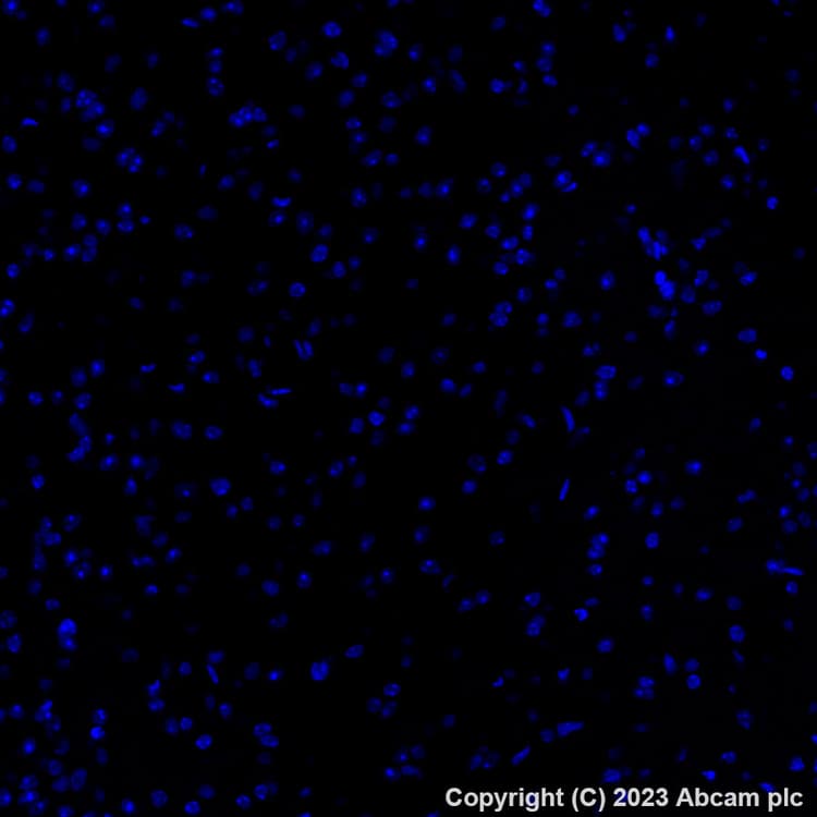 Alexa Fluor 647 Trpv1 Antibody Epr25057 67 Ab313673  Immunohistochemistry Formalin Pfa Fixed Paraffin Embedded Sections Img418126