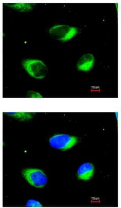Rrbp1 Antibody Ab95983  Immunocytochemistry Immunofluorescence Img13345
