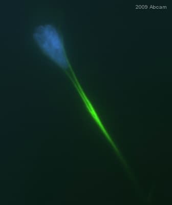 Anti-Vimentin antibody [RV202] - Cytoskeleton Marker(ab8978)