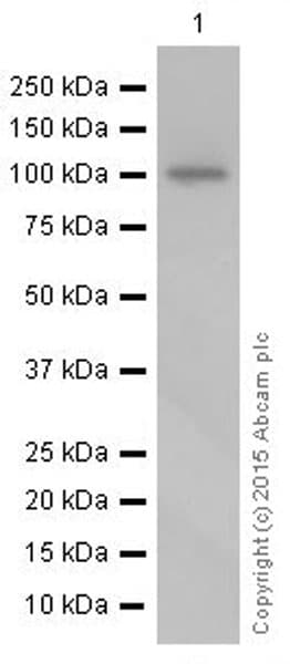 Anti-Sarcomeric Alpha Actinin antibody [EP2529Y](AB68167)