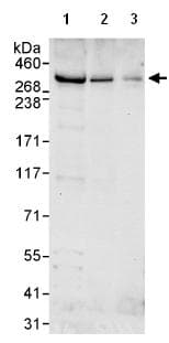 Chd6 Antibody Ab114095  Western Blot Img69975