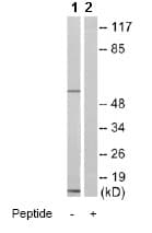Smad1 5 9 Antibody Ab80255  Western Blot Img10400