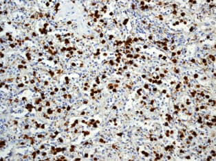 Anti-S100A8 antibody [EPR3554] - Low endotoxin, Azide free(AB219370)
