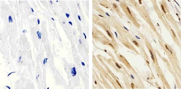 Anti-p38 (phospho T180 + Y182) antibody(AB4822)