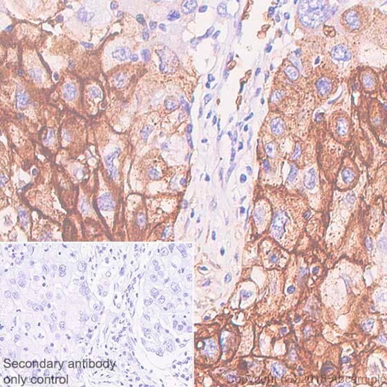 Anti-Glucose Transporter GLUT1 antibody [SP168](AB150299)