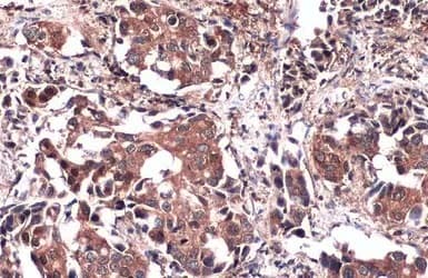 Pkm Antibody Ab137852  Immunohistochemistry Formalin Pfa Fixed Paraffin Embedded Sections Img449700