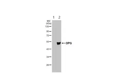 Anti-Osteoprotegerin antibody(AB183910)