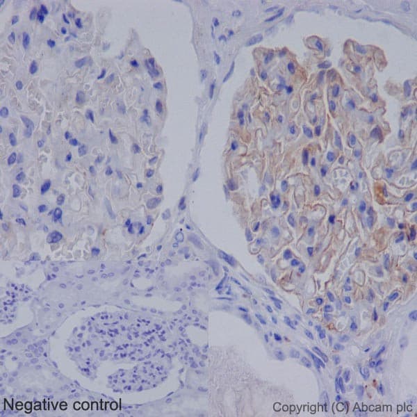 Anti-C1QA antibody [EPR14634](AB189922)