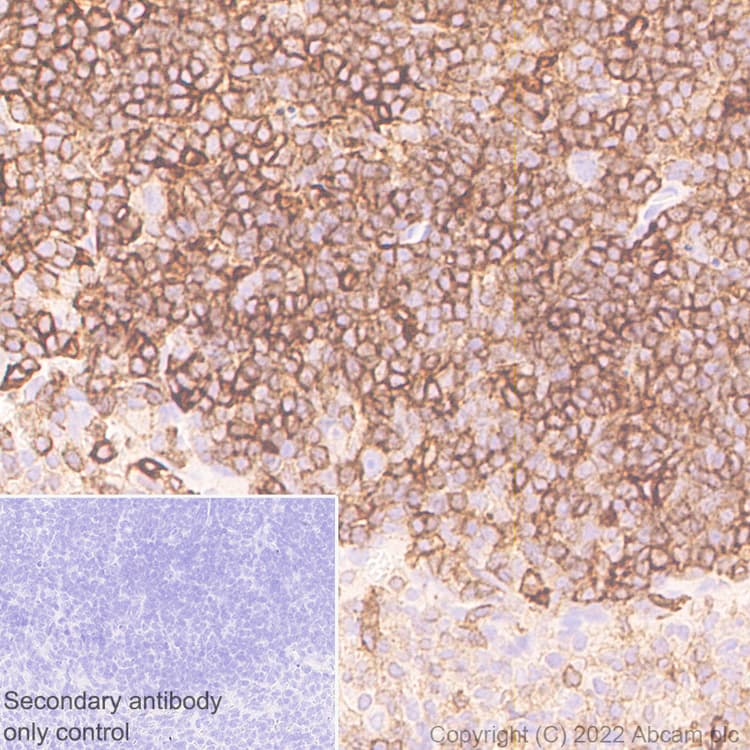 Semaphorin 4d Cd100 Antibody 30 Cd100 Ab307685  Immunohistochemistry Formalin Pfa Fixed Paraffin Embedded Sections Img408440