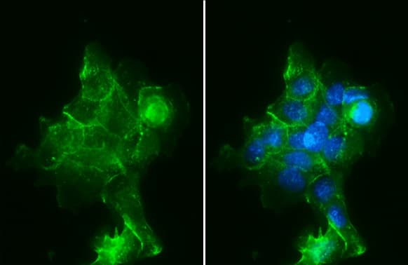 Anti-Sodium Potassium ATPase alpha 1 antibody [HL114](ab308329)