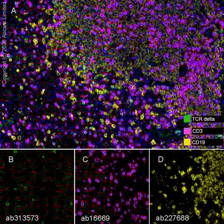 Anti-CD3 epsilon antibody [SP7] - BSA and Azide free(AB205228)