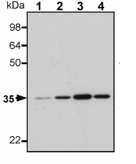 Anti-Calponin 1 antibody [EP798Y](AB46794)