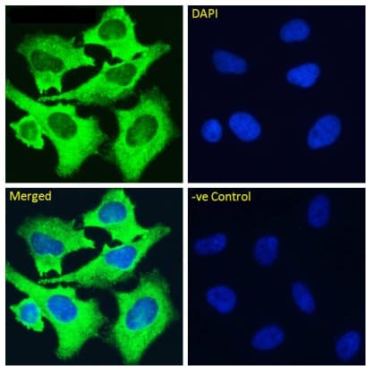 Integrin Alpha 5 Beta 1 Antibody M200 Volociximab Rabbit Igg Chimeric Ab275977  Immunocytochemistry Immunofluorescence Img55303