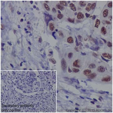Anti-METTL3 antibody [EPR18810](AB195352)