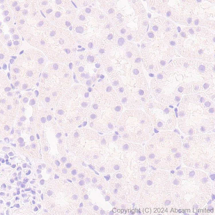 Anti-MASH1/Achaete-scute homolog 1 antibody [EPR19840](AB211327)