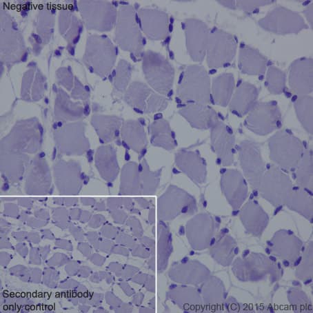 Il 2 Receptor Alpha Antibody Epr6452 Ab128955  Immunohistochemistry Formalin Pfa Fixed Paraffin Embedded Sections Img97050