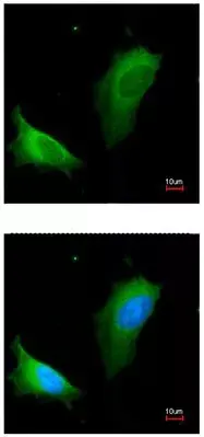 Anti-Liver Arginase antibody(AB96183)