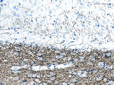 Anti-Tyrosine Hydroxylase antibody [EP1532Y] - Neuronal Marker(AB137869)