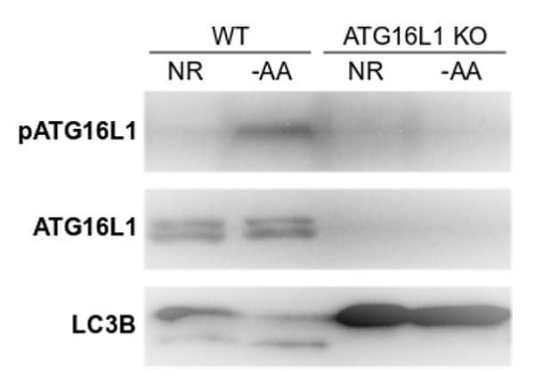 Autophagy Analysis (ATG16L1, ATG16L1 pS278, SQSTM1, LC3B, Ubiquitin, M6PR) Antibody Sampler Panel(AB269811)