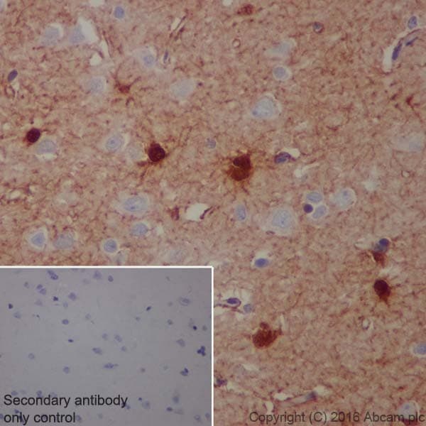 S100 Alpha Antibody Epr19013 Ab183979  Immunohistochemistry Formalin Pfa Fixed Paraffin Embedded Sections Img121427