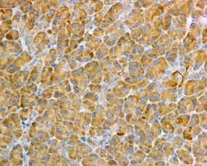 Txnrd1 Antibody Epr10205 Ab167411  Immunohistochemistry Formalin Pfa Fixed Paraffin Embedded Sections Img132922