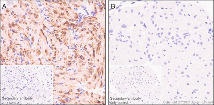 Natriuretic Peptides A Antibody Epr22089 283 Ab225844  Immunohistochemistry Formalin Pfa Fixed Paraffin Embedded Sections Img444410