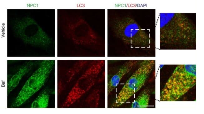 Anti-Niemann Pick C1 antibody [EPR5209](AB134113)