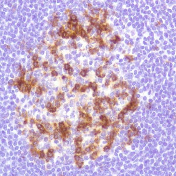 PD1 Antibody Panel (EPR4877(2), SP269, CAL20, NAT105, NAT105-EPR21106)(AB252192)