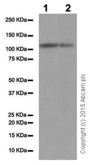 Anti-Androgen Receptor antibody [EP670Y](AB52615)