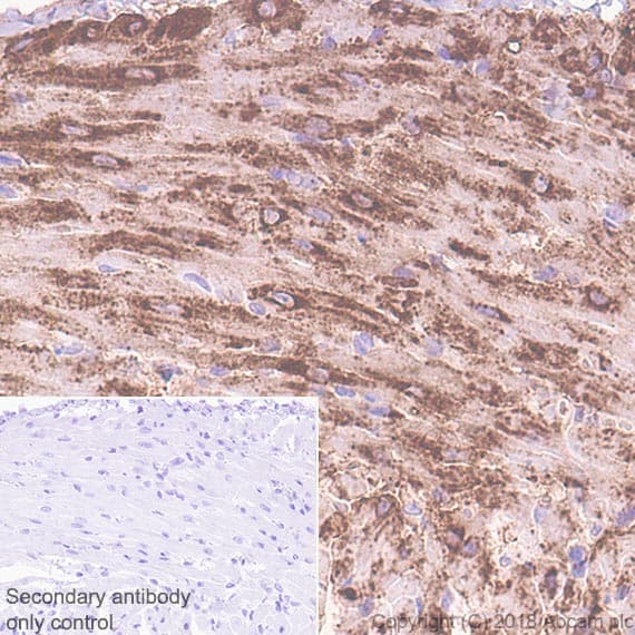 Natriuretic Peptides A Antibody Epr22089 283 Ab225844  Immunohistochemistry Formalin Pfa Fixed Paraffin Embedded Sections Img25264