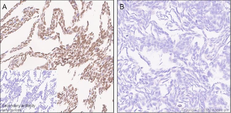 Anti-ZEB1 antibody [EPR26184-63] - BSA and Azide free(AB303481)