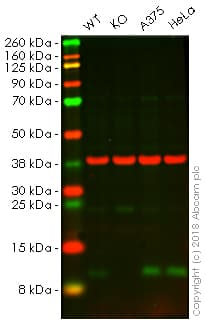 Anti-S100A4 antibody [EPR14639(2)](AB197896)
