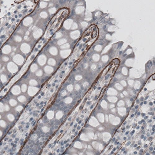 Anti-Laminin alpha 5/LAMA5 antibody [CL3118](AB210957)
