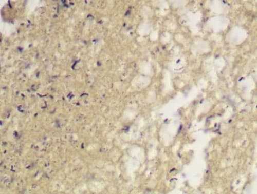 Gram Stain Kit (Microorganism Stain)(AB150672)